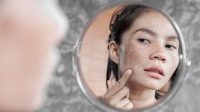 Kulit_merah_setelah_makan_Waspadai_Rosacea_gejala__solusinya