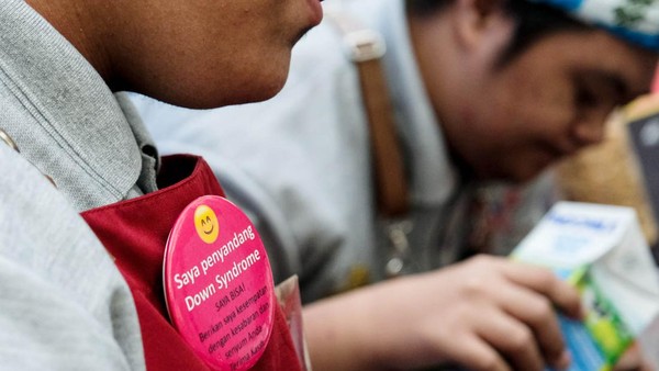Down Syndrome dan Keturunan: Mitos atau Fakta? Dokter Menjawab