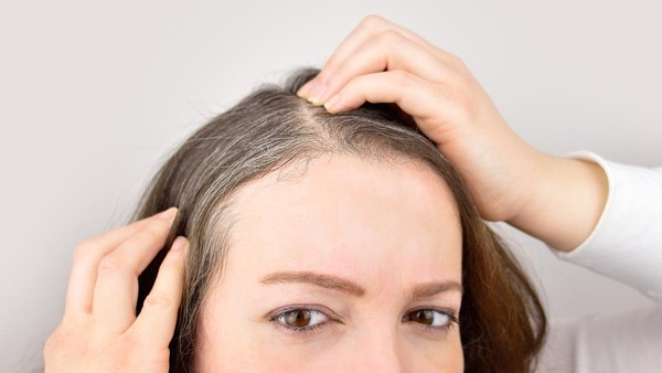 Rambut Beruban Muda? Penyebab & Solusi Utamanya Terungkap