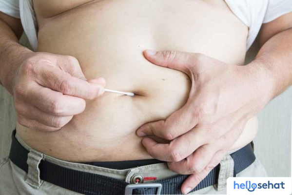 Atasi Bau Pusar: Penyebab & Solusi Ampuh Segera