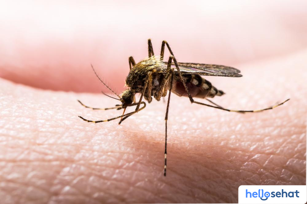 Atasi Gigitan Agas: 5 Langkah Pertolongan Pertama Ampuh