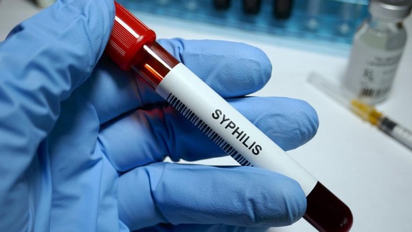Waspada Sifilis! 23 Ribu Kasus di Indonesia, Gejala & Pencegahannya